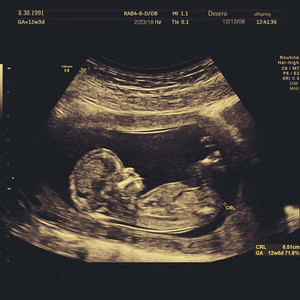 成年女人毛片免费观看不卡
